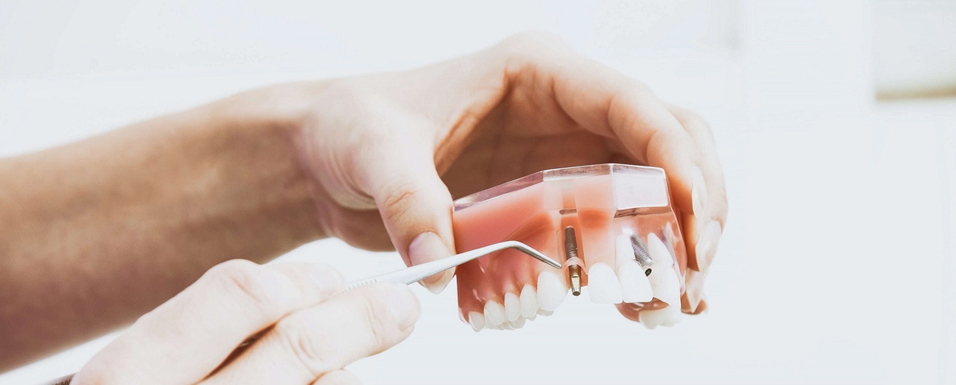 Real Estate Belgrade | Dental implants Belgrade